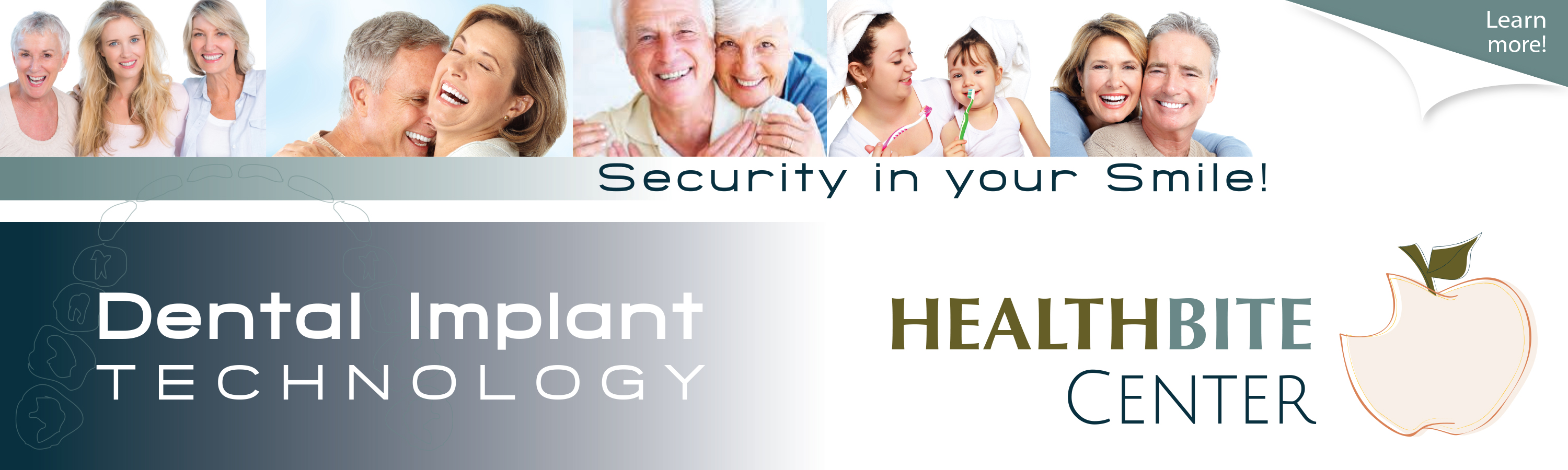 HealthBite Center State of the Art Dental Implants