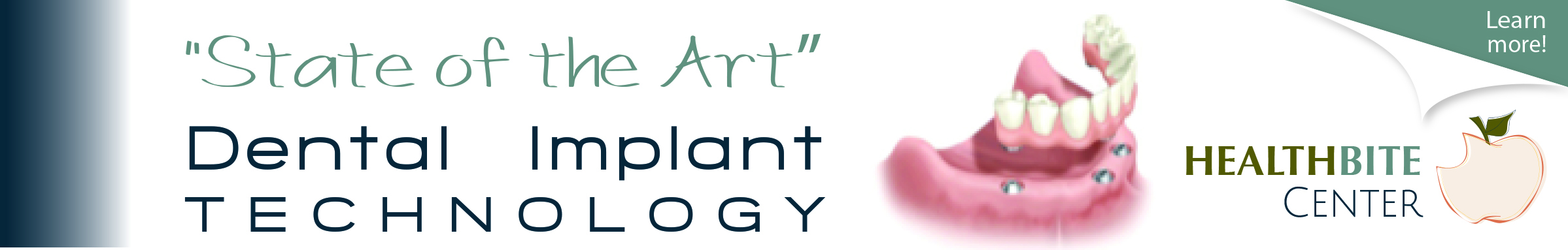 HealthBite Center "State of the Art" Dental Implants